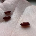 what is this on my bed with small reddish brown objects