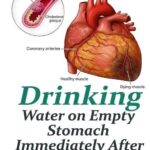 : Heart attack illustration with a headline claiming that drinking water immediately after waking affects heart attack risk.