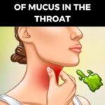 Mucus in throat causes and reasons for excess throat mucus buildup
