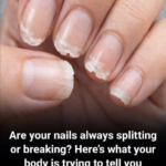 Close-up of splitting and breaking nails with peeling tips