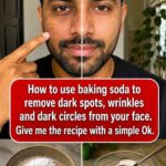 baking soda on the face for dark spots wrinkles and dark circles