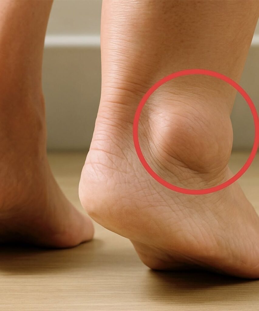 Swollen feet and ankle showing signs of edema